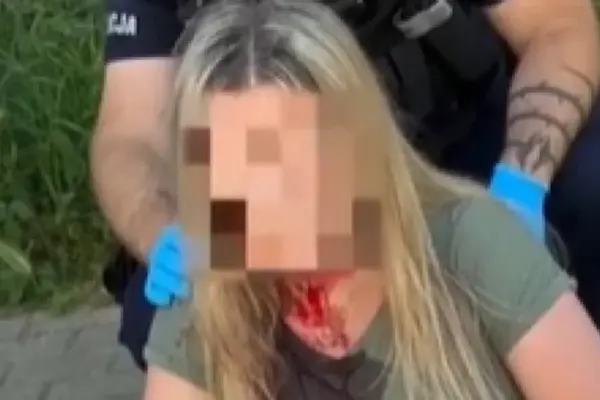 Хронологія справи в Гдині: напад тростиною 30 липня і затримання 1 серпня